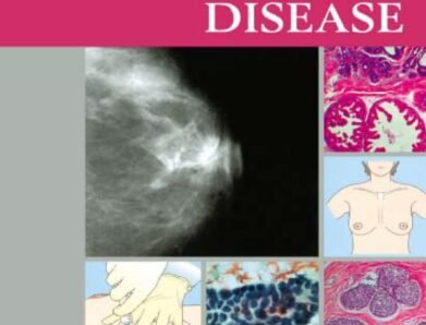 An Atlas of Breast Disease