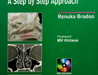 Anatomical Principles of Endoscopic Sinus Surgery