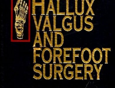 Hallux Valgus and Forefoot Surgery