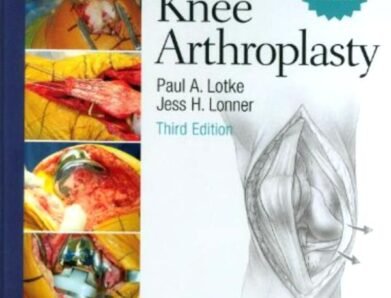 Knee Arthroplasty – Master Techniques in Orthopaedic Surgery